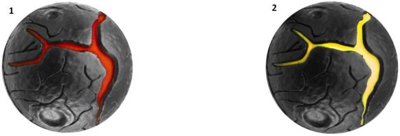 Waboba Lava Ball-2 Σχέδια (C02G0130106-130109)